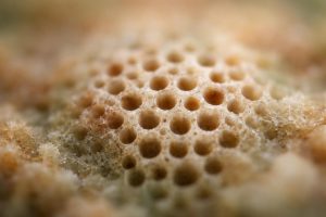 Trypophobie Test : Vérifiez Votre Niveau de Phobie